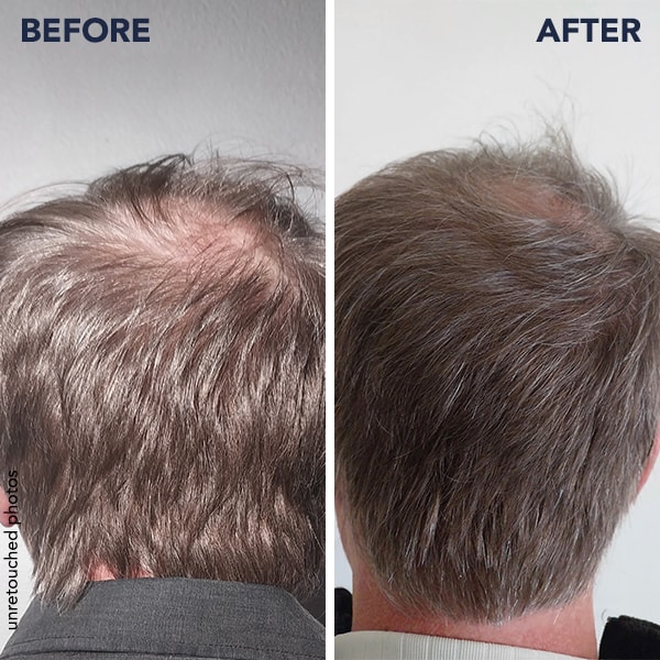 100% ΙΚΑΝΟΠΟΙΗΣΗ